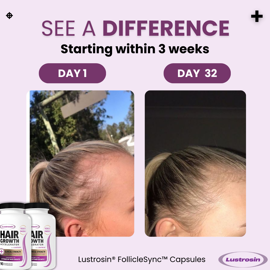 Lustrosin® FollicleSync™ Capsules (Labor Day Sale 28% Off)