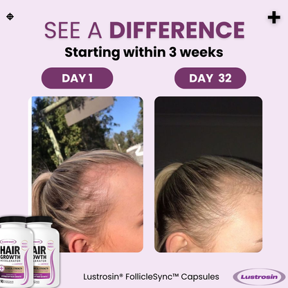 Lustrosin® FollicleSync™ Capsules (Labor Day Sale 28% Off)